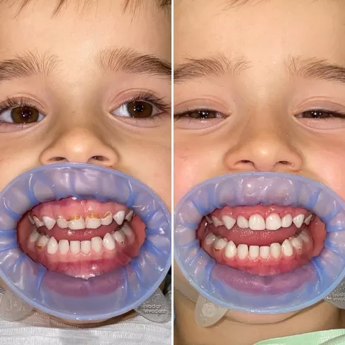 Леонардо, 3 роки