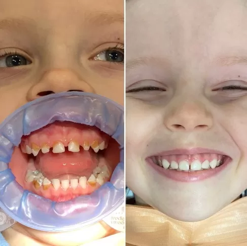 Давид, 3 роки